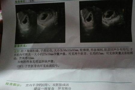 一年生两个孩子的几率有多大