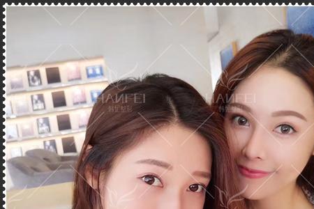 玻尿酸全脸填充什么牌子好