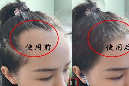 生发液怎么用
