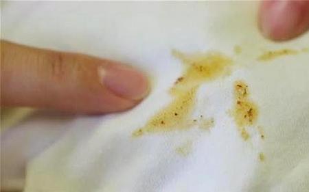 手上沾顽固油渍怎样去除