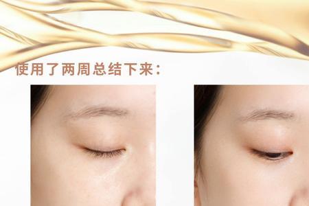 氧化和暗沉的区别
