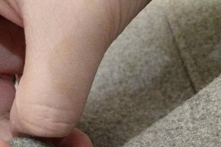 怎么在缝好的扣子上加固