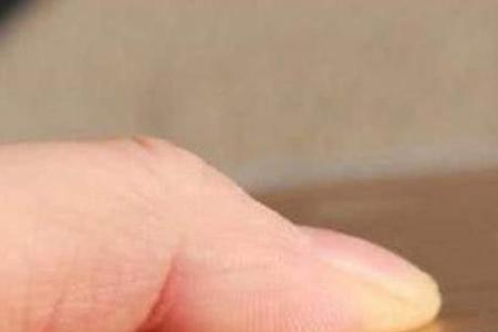 手机下方的三道杠失灵了怎么办