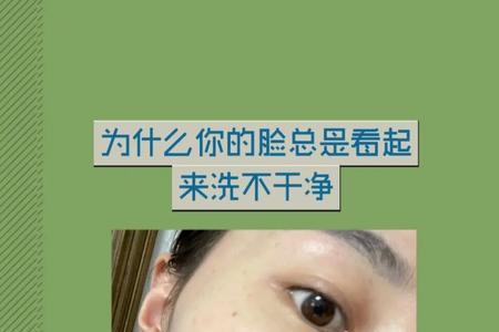 为什么一拍照脸就看起来很脏