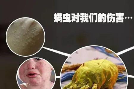 蠓虫多是怎么回事