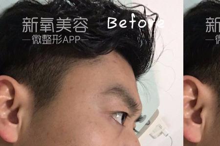 地包天适合什么发型男