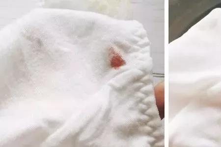 奶渍发黄怎么洗