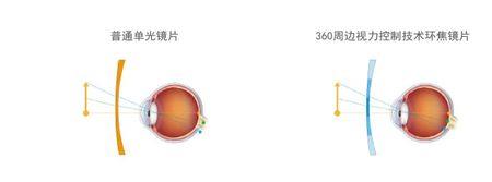 多焦与环焦的区别
