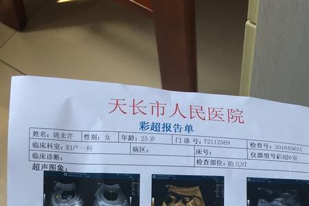 怀孕84天是几周