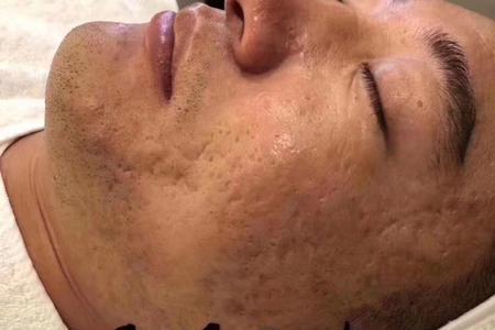 珊瑚焕肤为什么不能洗脸