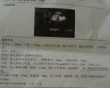 qzuser啥意思