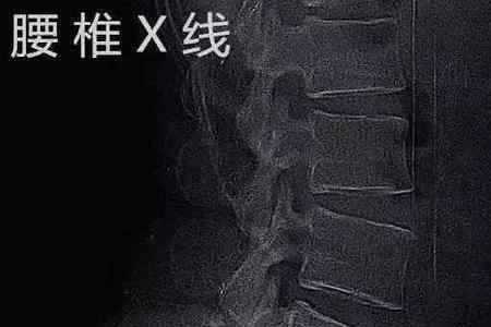后腰是哪个位置