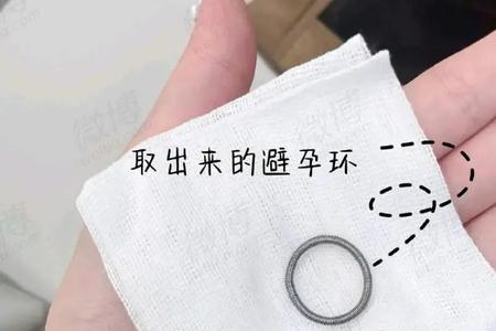 摘避孕环走医保吗