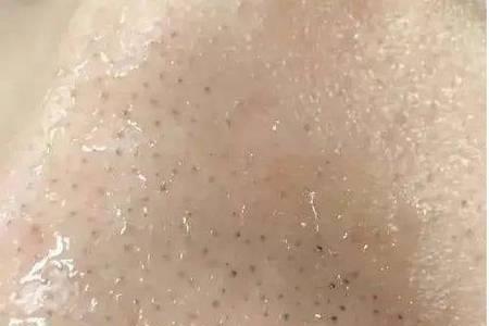 欧诗漫双色泥膜怎么样