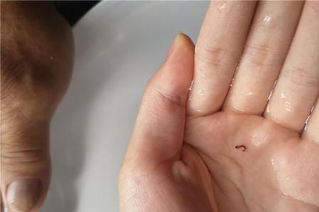 为什么水里有小蠕虫