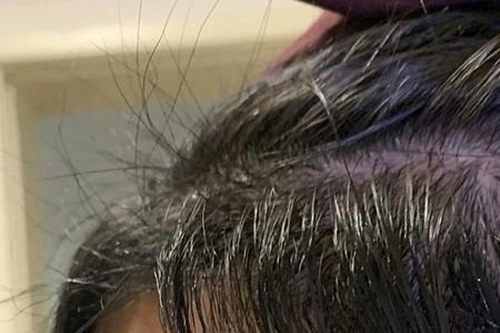 洗脸时总是要把头发弄湿怎么办