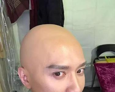 光头如何不长头发