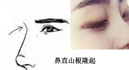 夫妻隔角什么意思