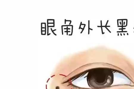 形容眼角有痣的诗词