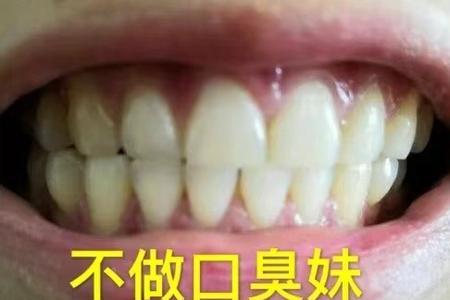 欧丹锦牙粉一瓶用多久