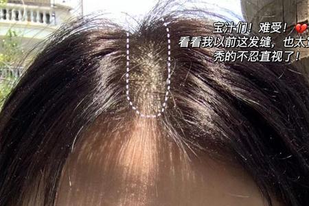 洗头洗发膏抹发际线上有事吗