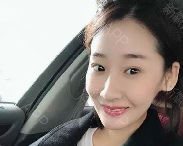 门牙比较大的mm怎么笑好看