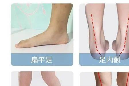 孩子骨架小怎么改善