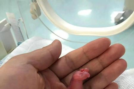 苏州每年出生多少婴儿