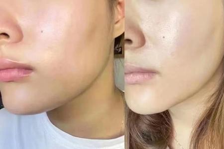 什么面膜能让脸胖