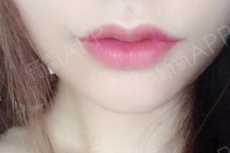 玉唇什么意思