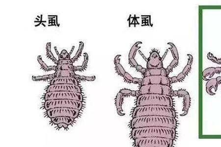 虱子虫卵离开人体能孵化吗