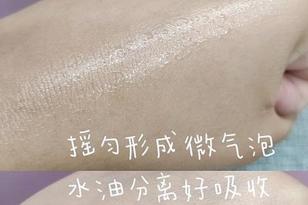 极光水爆痘是什么原因