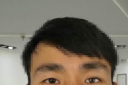 义眼全国做得最好的是哪里