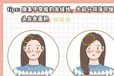 夏天头发静电贴头皮