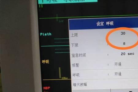 心电监护报警声音怎么关闭