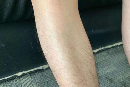 为什么有的男生腿毛是弯的