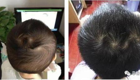 六个旋是什么意思