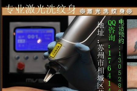 苏州哪家医院洗纹身便宜效果好