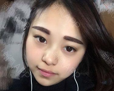 纹眉4年还没掉色怎么办