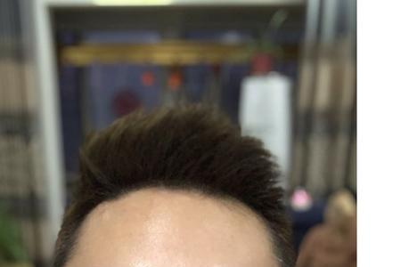 格丽斯用填充剂吗