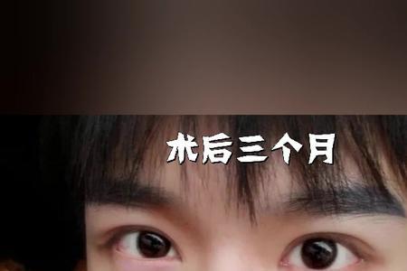 科比单眼皮还是双眼皮