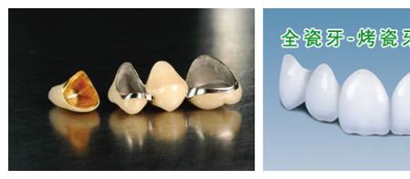 全瓷牙保修卡是三年