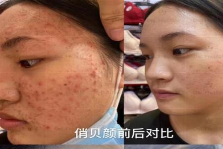 净俏颜护肤品怎么样