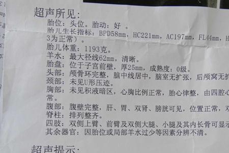 宝宝2386克是多少斤