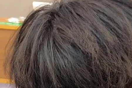 男生常年烫头发会秃吗