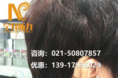 助听器用15v的电池行不