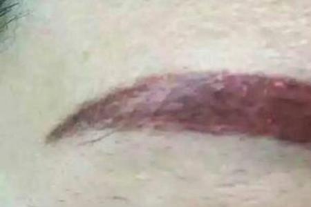 纹眉是割一条线吗