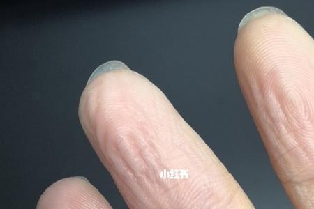 火碱使用完手发干怎么办
