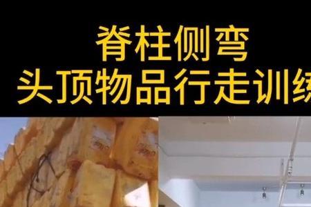 为什么有的人头顶有个窝