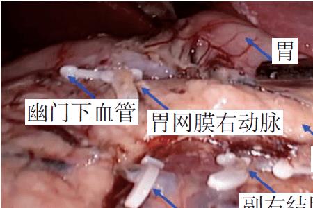 猪网膜是什么